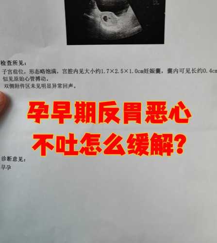 孕反突然加剧是怎么回事-第1张图片