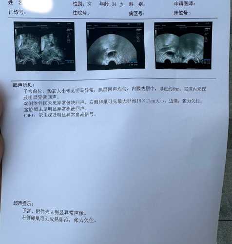 服用西比灵多久可备孕-第1张图片