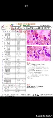新生儿血小板高是怎么回事-第1张图片