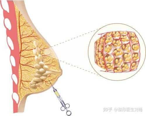 产后乳房小硬疙瘩怎么办-第1张图片