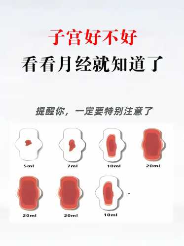 产后月经来得早好还是晚好-第1张图片