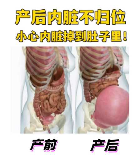 产后宫腔分离是什么-第1张图片