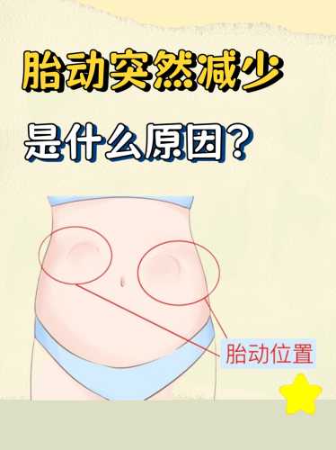 备孕的胎动感受是什么-第1张图片