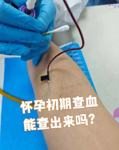 血常规检查能查怀孕吗-第1张图片