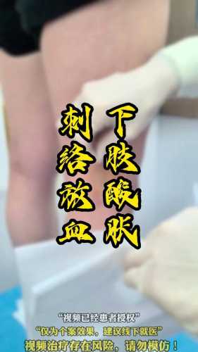 孕反可用针灸放血吗-第1张图片
