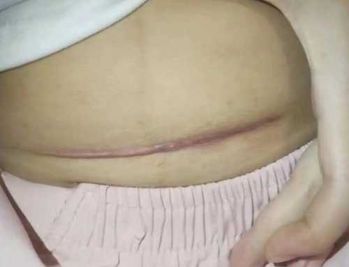 河北生殖妇产剖腹产多少钱-第1张图片