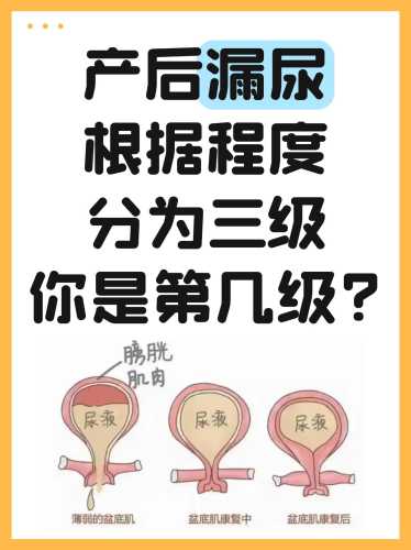 产后尿骚味重怎么办-第1张图片