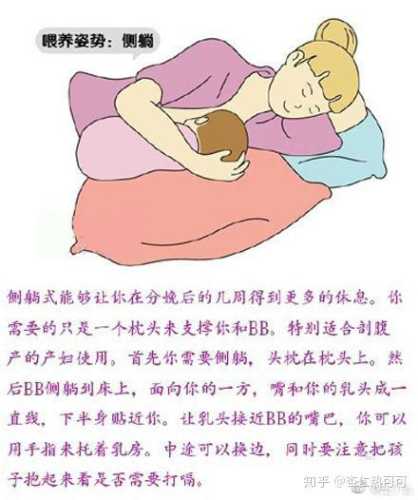 剖腹产后如何喂奶-第1张图片