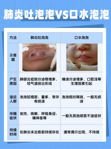 新生儿吐泡泡是怎么回事-第1张图片