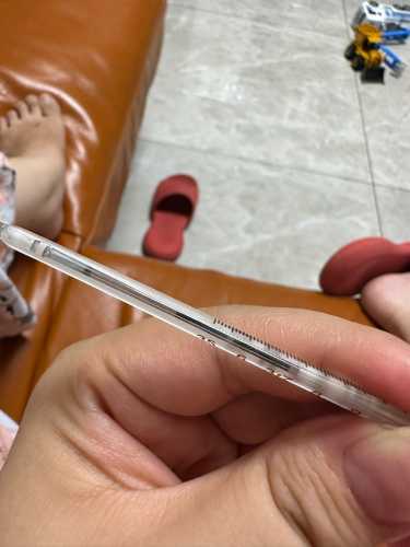 婴儿低烧症状有哪些-第1张图片