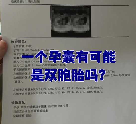 两个卵子能怀孕吗-第1张图片