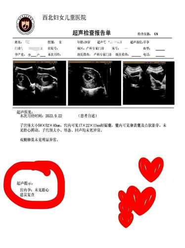 平扫ct对备孕有影响吗-第1张图片