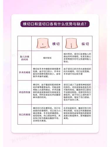 剖腹产可以提前多久剖-第1张图片