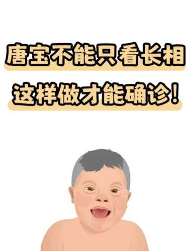 断掌的婴儿意味着什么-第1张图片