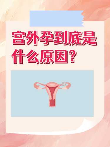 宫外孕后多久能再怀孕-第1张图片