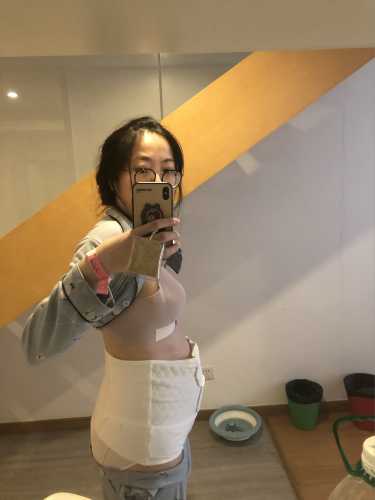 刨腹产后多久可以化妆-第1张图片