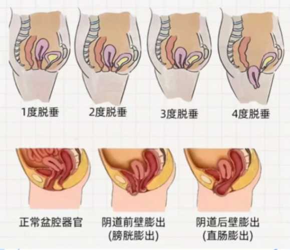 如何看懂产后子宫图-第1张图片