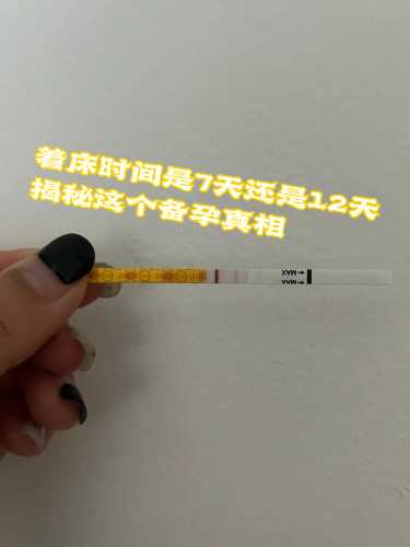 备孕前抗体检测是什么-第1张图片