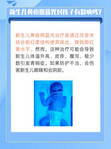 新生儿蓝光治疗注意什么-第1张图片