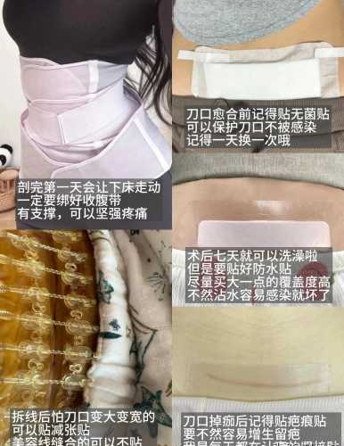 剖腹产为何不能缝合-第1张图片