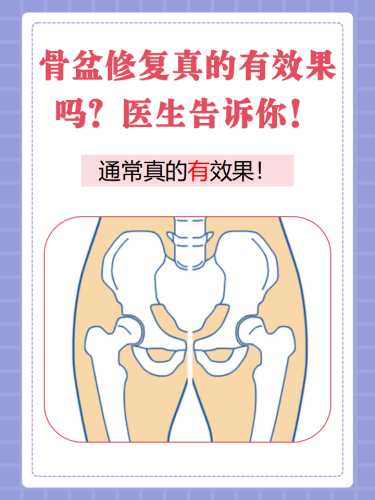 产后盆骨该如何进行修复-第1张图片
