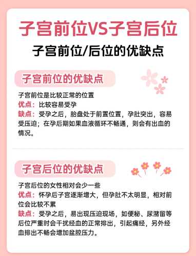 子宫后位易顺产吗-第1张图片