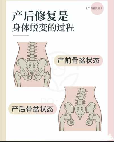 产后崩漏有哪些具体症状-第1张图片