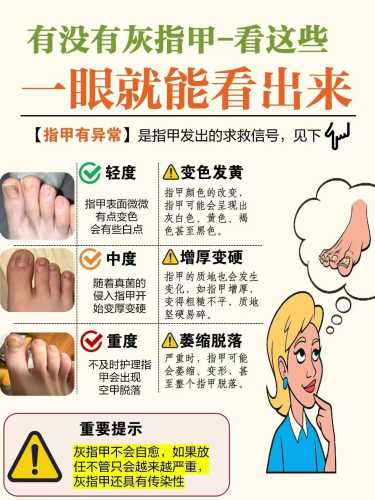 备孕灰指甲怎么治愈-第1张图片