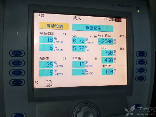 新生儿正压通气频率是多少-第1张图片