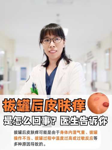 流产后能拔罐吗-第1张图片