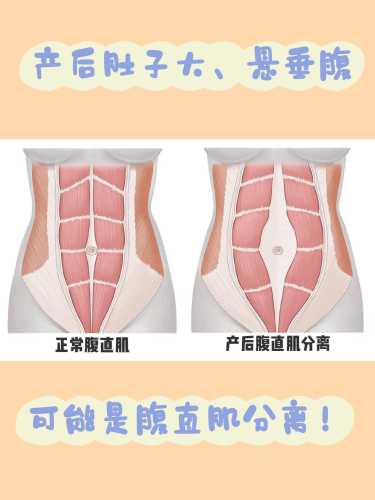 产后妈妈图片都有哪些类型-第1张图片