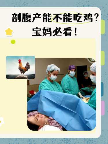 剖腹产有哪些注意话语-第1张图片