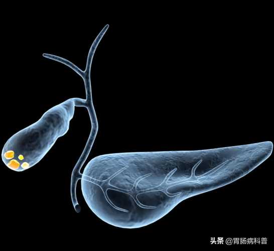 坐月子为何易患结石-第1张图片