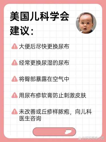 预防尿布疹选什么尿不湿好-第1张图片