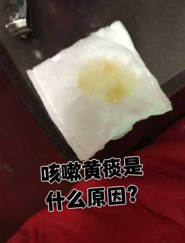 新生儿有痰是不是得了肺炎-第1张图片