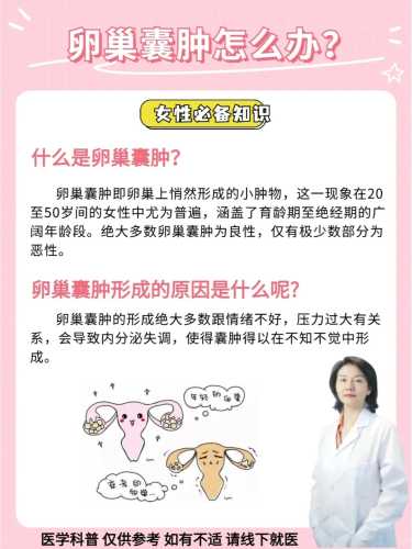 左附件囊肿影响备孕吗-第1张图片
