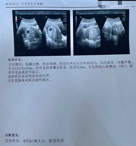孕期毫无孕反正常吗-第1张图片