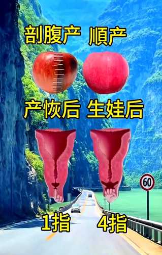 竖刨后能顺产吗-第1张图片