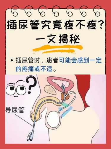 剖腹产插尿管视频教程在哪找-第1张图片