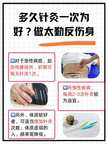 孕反扎针灸有效吗-第1张图片