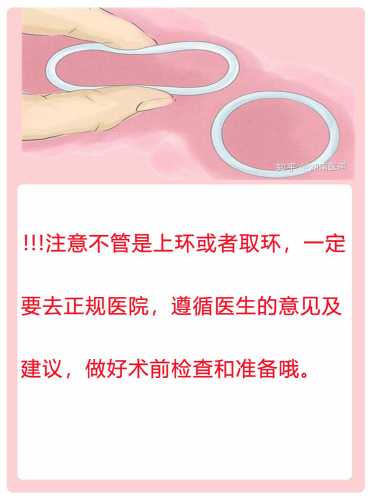 流产后多久能戴节育环-第1张图片