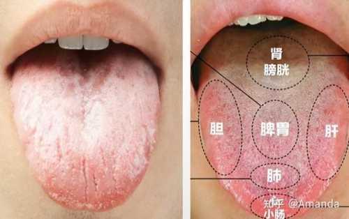 产后舌苔厚白如何调理-第1张图片