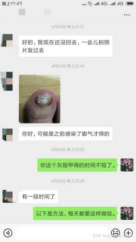 灰指甲和备孕到底有没有关系-第1张图片
