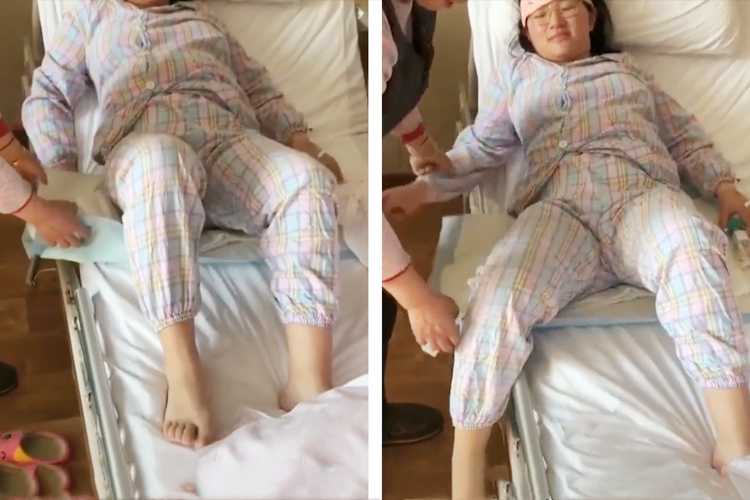 剖腹产后能蹲吗-第1张图片