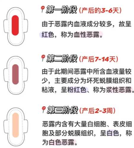 产后多久恶露才能排干净-第1张图片