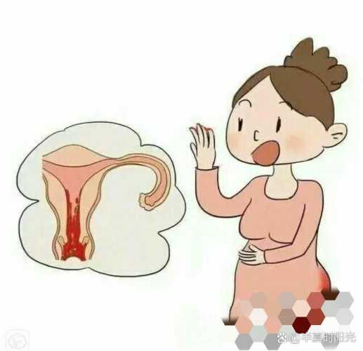 产后二十天恶露暗红色正常吗-第1张图片