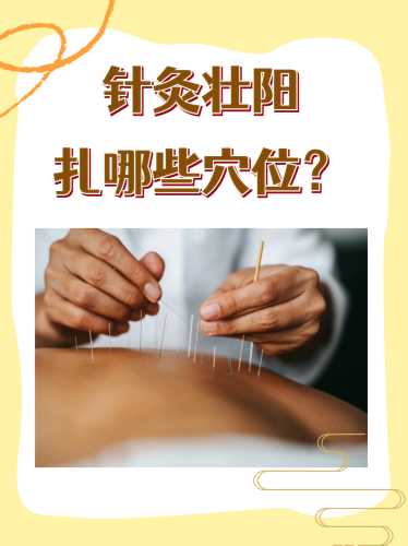 备孕能不能扎针灸治疗-第1张图片