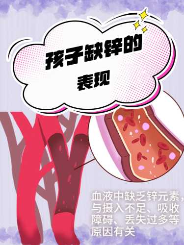 婴儿缺锌有啥症状表现-第1张图片