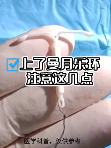 剖腹产后上环有哪些危害-第1张图片