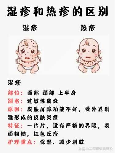 婴儿湿疹和热疹咋区分-第1张图片
